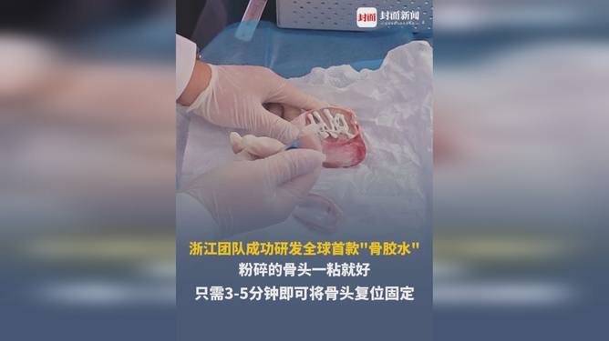 全球首款骨胶水是什么全球首款骨胶水，引领医疗与材料科学的革命性创新